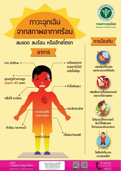 สคร.10 อุบลฯ เตือนอากาศร้อนระวังป่วยโรคลมแดดหรือฮีทสโตรก