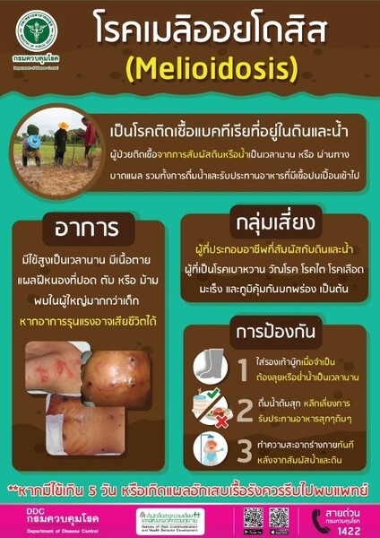 สคร.10 อุบลฯ เตือนประชาชนระวังป่วยด้วย โรคเมลิออยโดสิส	