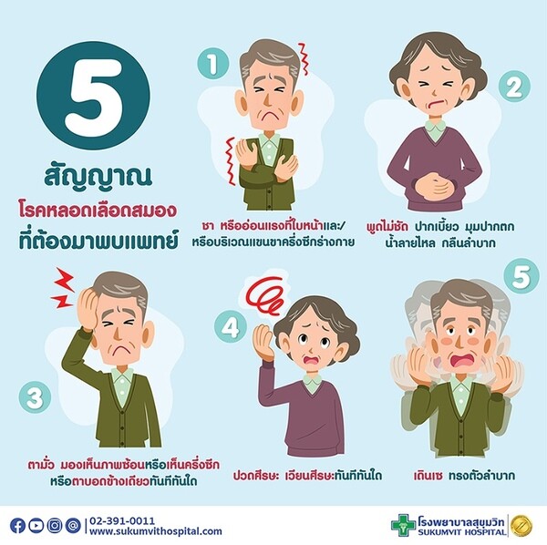 5 สัญญาณโรคหลอดเลือดสมองที่ต้องมาพบแพทย์