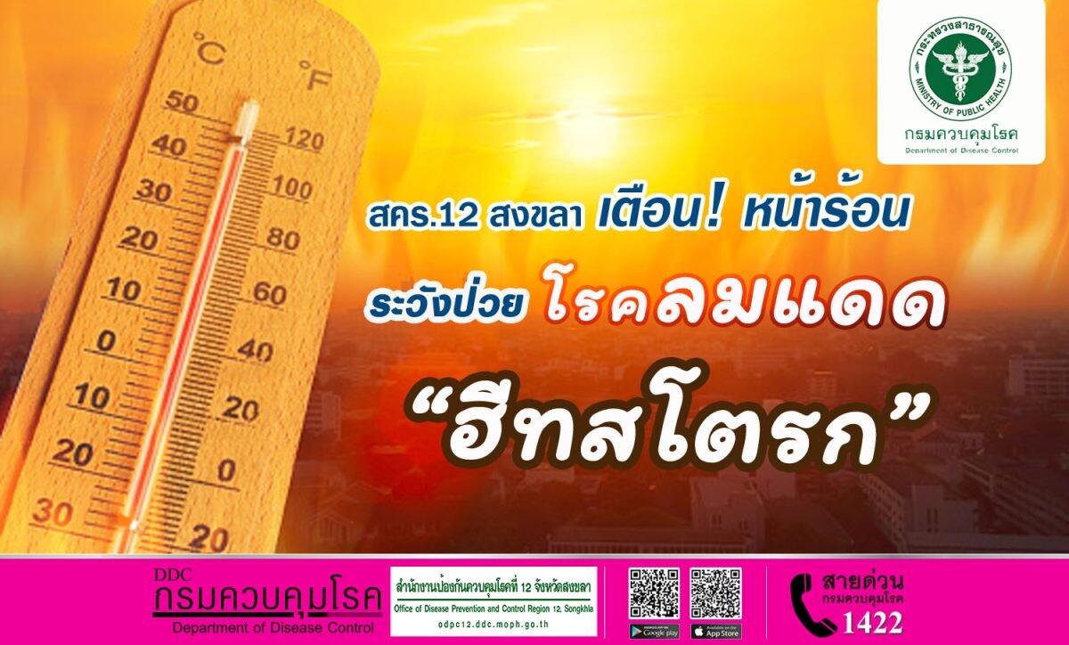 สคร.12 สงขลา เตือน หน้าร้อน ระวังป่วยโรคลมแดดหรือ"ฮีทสโตรก" แนะหลีกเลี่ยงการอยู่กลางแดดที่ร้อนจัด