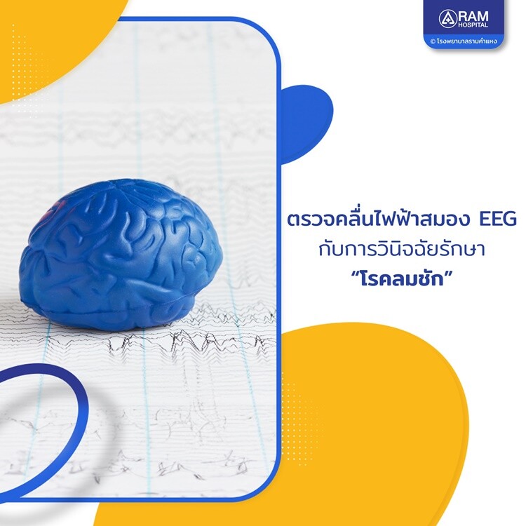 ตรวจคลื่นไฟฟ้าสมอง EEG กับการวินิจฉัยรักษา "โรคลมชัก"