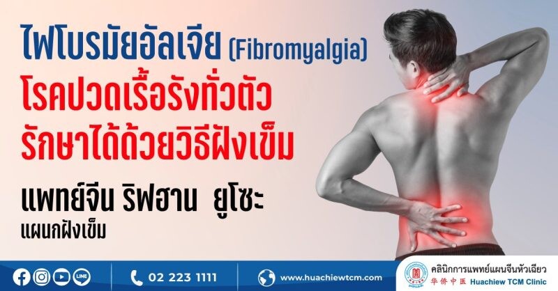 ไฟโบรมัยอัลเจีย (Fibromyalgia) โรคปวดเรื้อรังทั่วตัว รักษาได้ด้วยศาสตร์การแพทย์แผนจีน โดย คลินิกการแพทย์แผนจีนหัวเฉียว