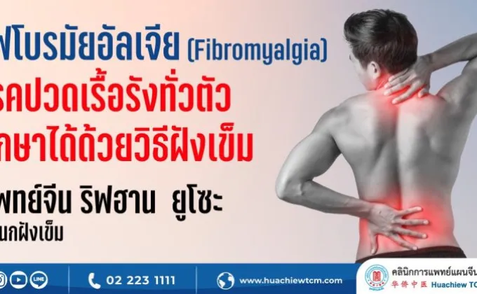 ไฟโบรมัยอัลเจีย (Fibromyalgia)