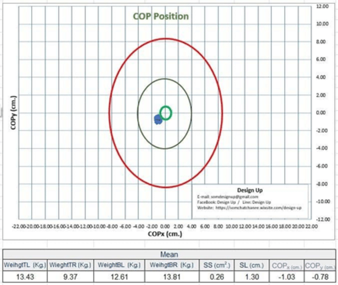 Always on Alert for Balance Loss with "The Balance Assessment Device," An Outstanding Innovation by Chula Researcher