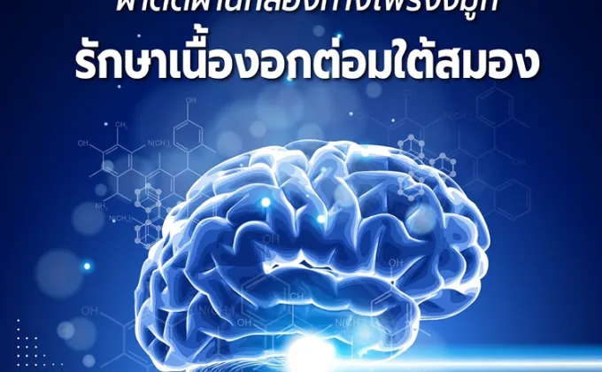 ผ่าตัดผ่านกล้องทางโพรงจมูก รักษาเนื้องอกต่อมใต้สมอง