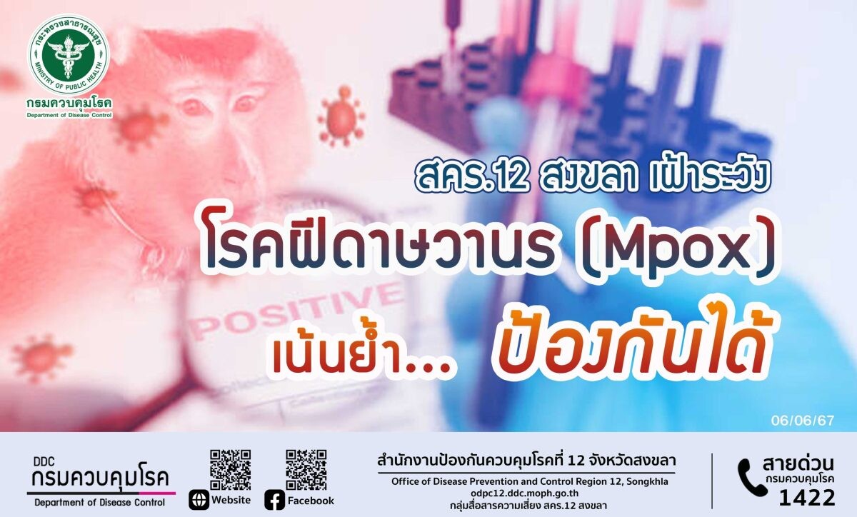 สคร.12 สงขลา เฝ้าระวัง โรคฝีดาษวานร (Mpox) เน้นย้ำ ป้องกันได้