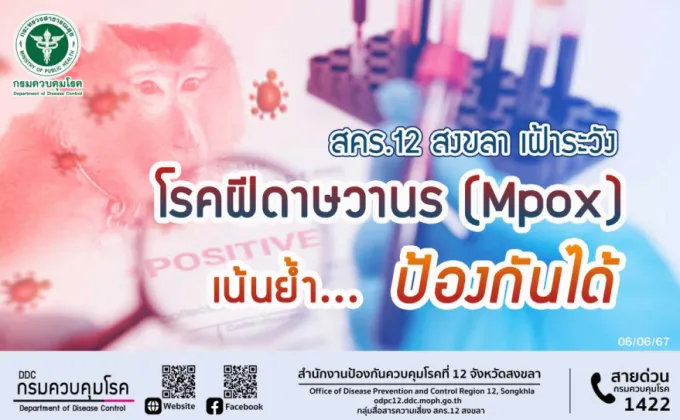 สคร.12 สงขลา เฝ้าระวัง โรคฝีดาษวานร