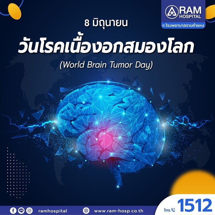 8 มิถุนายน วันโรคเนื้องอกสมองโลก (World Brain Tumor Day)