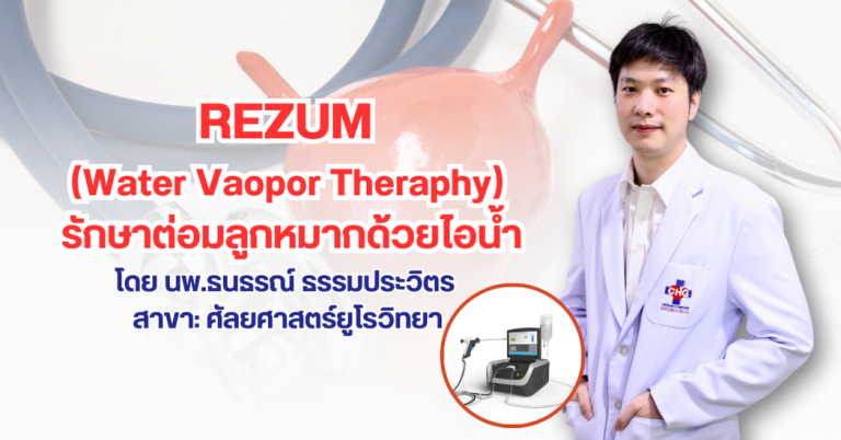 การรักษาโรคต่อมลูกหมากโต Rezum water vapor therapy