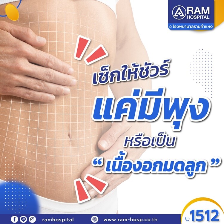 เช็กให้ชัวร์! แค่มีพุง หรือ เป็น "เนื้องอกมดลูก"