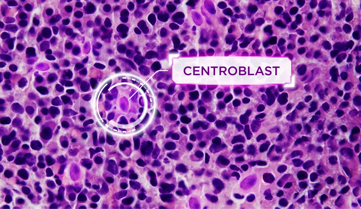 Siriraj Hospital Integrates AI to Elevate Medical Research and Diagnosis, Touts YOLO Model for Centroblast Cell Counting