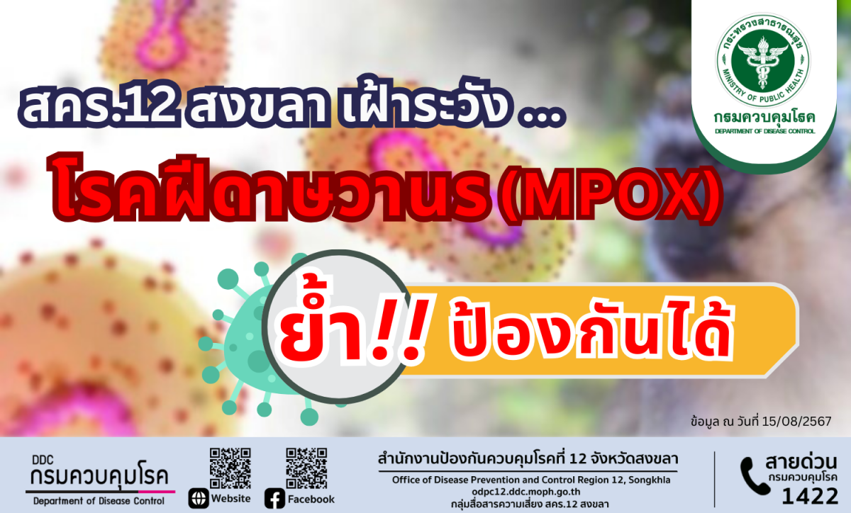 สคร.12 สงขลา เฝ้าระวังโรคฝีดาษวานร (Mpox) ย้ำ ป้องกันได้