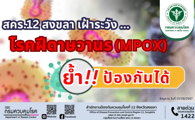 สคร.12 สงขลา เฝ้าระวังโรคฝีดาษวานร