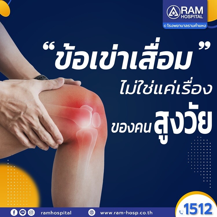 "ข้อเข่าเสื่อม" ไม่ใช่แค่เรื่องของคนสูงวัย