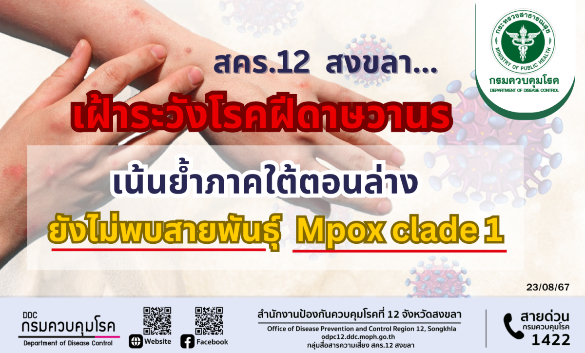 สคร.12 สงขลา เฝ้าระวังโรคฝีดาษวานร เน้นย้ำภาคใต้ตอนล่าง ยังไม่พบสายพันธุ์ Mpox clade 1