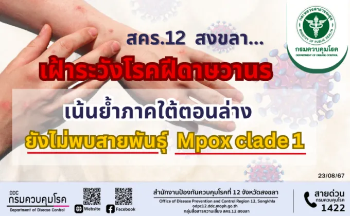 สคร.12 สงขลา เฝ้าระวังโรคฝีดาษวานร