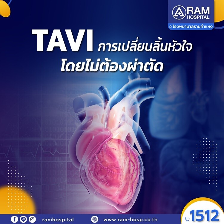 TAVI การเปลี่ยนลิ้นหัวใจ โดยไม่ต้องผ่าตัด