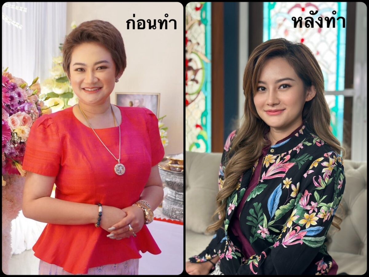 เปลี่ยนไปมาก "หมอปลาย" ย่องทำจมูก สวย หวาน จนเกือบจำไม่ได้