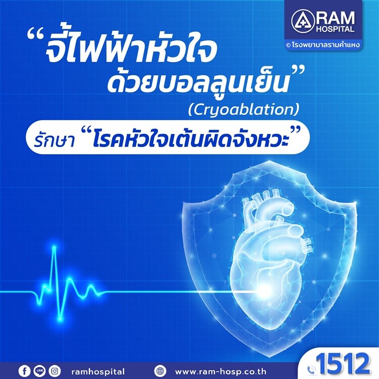 "จี้ไฟฟ้าหัวใจด้วยบอลลูนเย็น" (Cryoablation) รักษา "โรคหัวใจเต้นผิดจังหวะ"