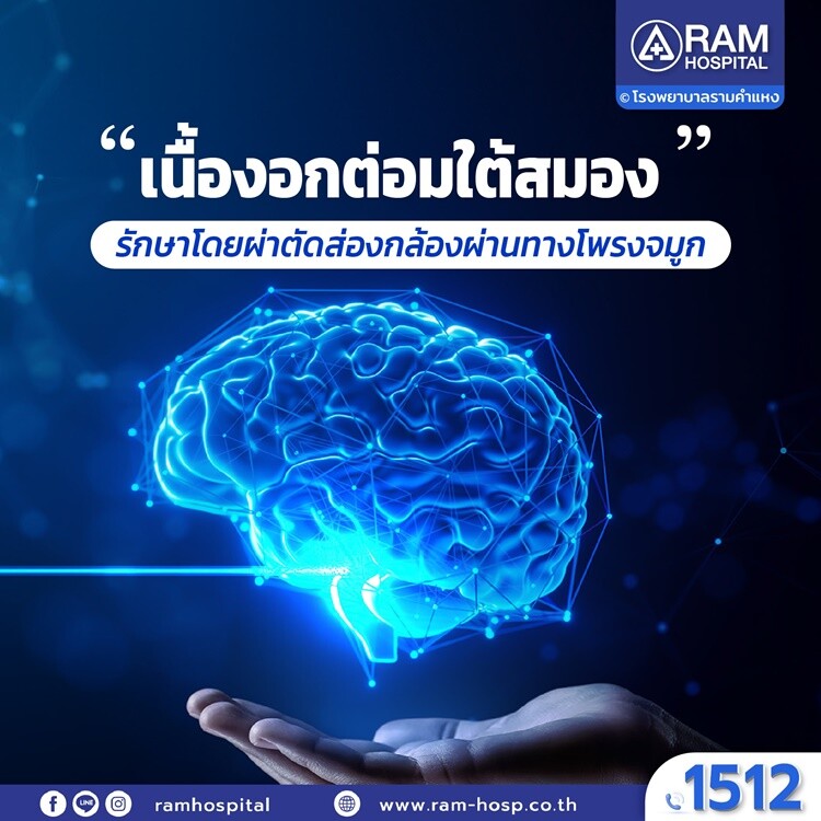 "เนื้องอกต่อมใต้สมอง" รักษาโดยผ่าตัดส่องกล้องผ่านทางโพรงจมูก