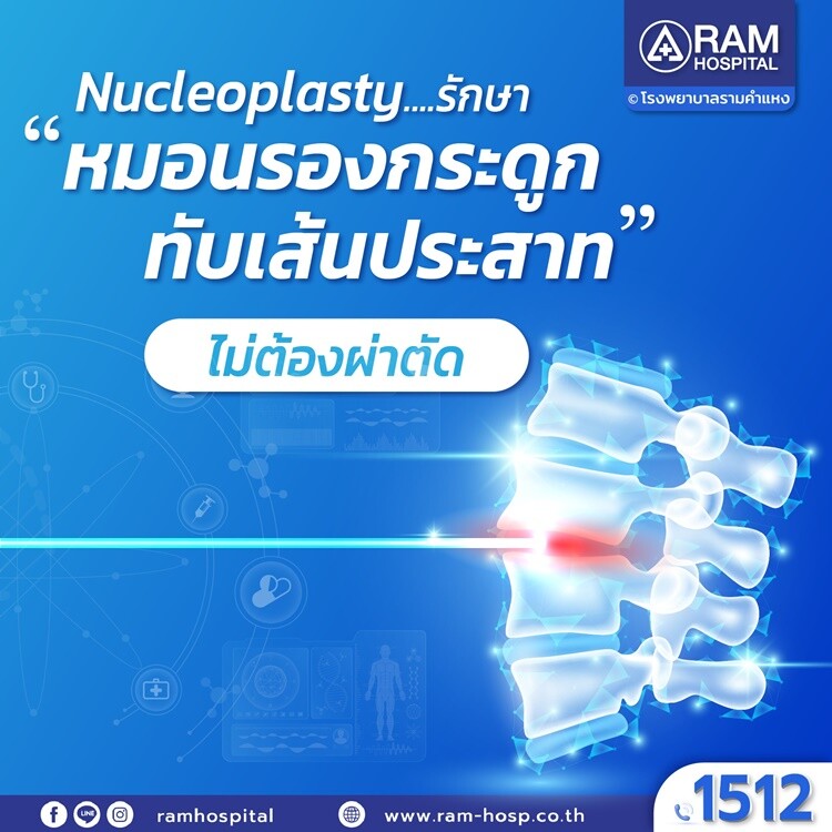 Nucleoplasty รักษา "หมอนรองกระดูกทับเส้นประสาท" ไม่ต้องผ่าตัด