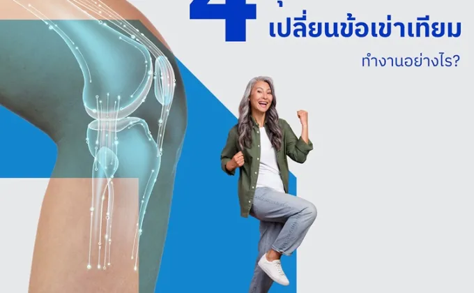 4 ขั้นตอน หุ่นยนต์ช่วยผ่าตัดเปลี่ยนข้อเข่าเทียมทำงานอย่างไร?