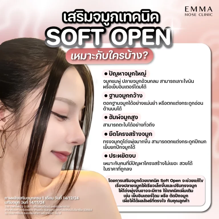 พาไปรู้จัก เทคนิคแก้จมูก Soft Open เทคนิคมาแรงรับปี 2025