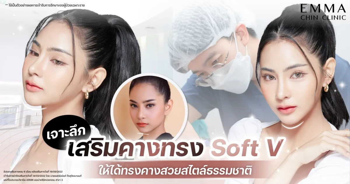 เทรนด์คางปี 2025 พาเจาะลึกเสริมคางทรง Soft V